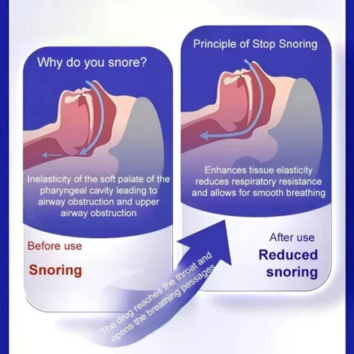 Acupuncture Point Pressure Anti-Snoring Patch - Image 4