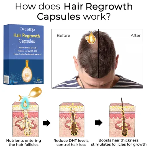 Oveallgo™ Hair Regrowth Capsules - Image 4