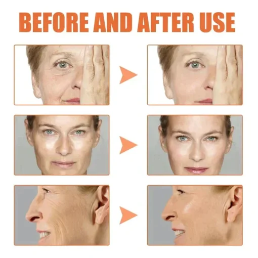 Botox Facial Essence - Image 6