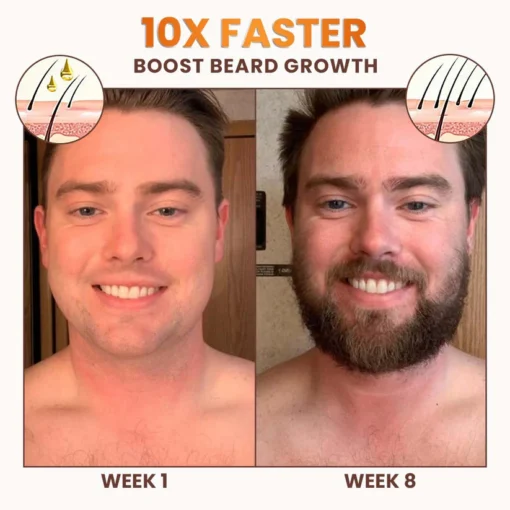 Stovis™ Premium Biotin Hair&Beard Booster - Image 8