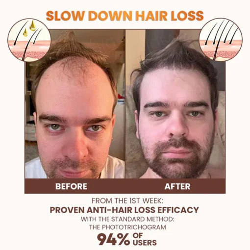Stovis™ Premium Biotin Hair&Beard Booster - Image 5