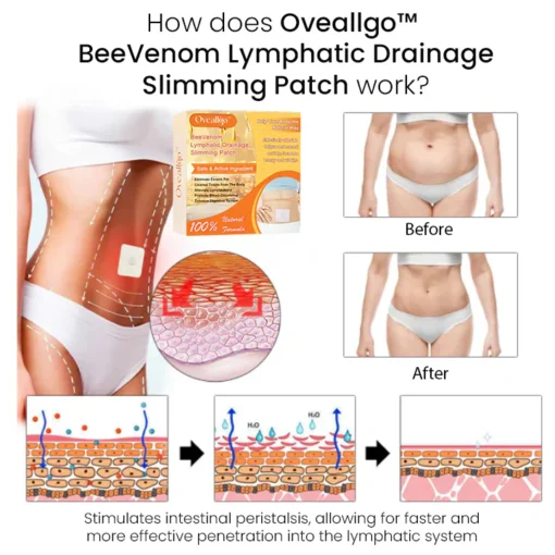 Oveallgo™ BeeVenom Lymphatic Drainage Slimming Patch - Image 3