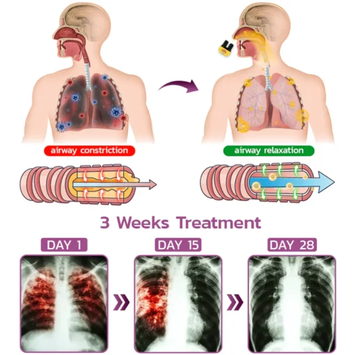 GFOUK™ Beerify Lung Cleanse Inhaler - Image 6