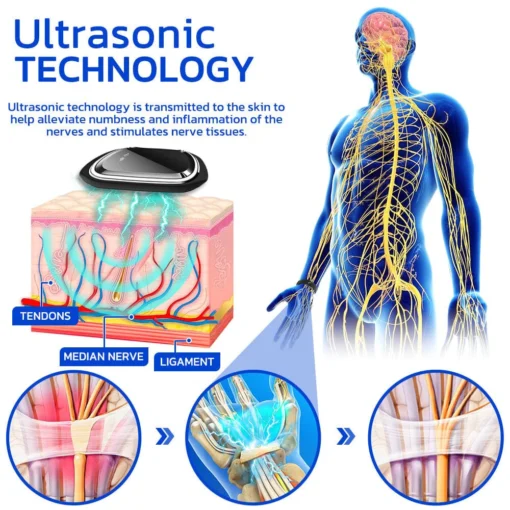 Furzero™ NumbSolved Ultrasonic Device - Image 4