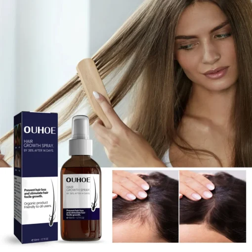 OUHOE Natural Hair Regrowth Spray - Image 2