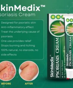 SkinMedix™ Natural Herbaceous Plants Psoriasis Cream