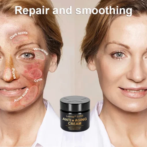 Lotmay™ Super Anti-Aging Cream - Image 9