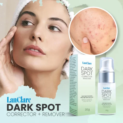 LanClare™ Triple-Active Brightening Dark Spot Corrector Remover