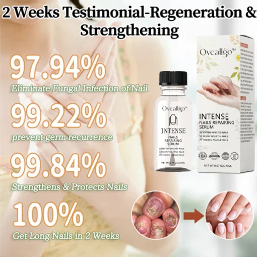 Oveallgo™ NailGro Intense Nail Growth and Strengthening Serum - Image 3