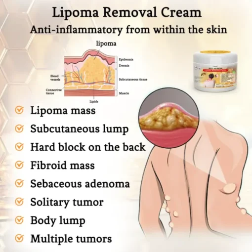 Bee Venom Lipoma Removal Cream - Image 3