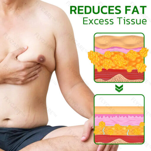 FLYCARE™ TurmericMax Gynecomastia Compress Patch - Image 5