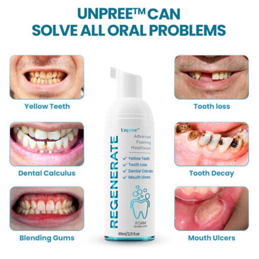 Unpree™ Regenerate Teeth Mouthwash – Foam Technology Solve All Oral Problems - Image 3