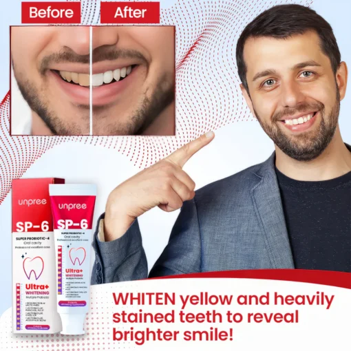 Unpree™ SP-6 Ultra+ Probiotic Whitening Toothpaste - Image 7