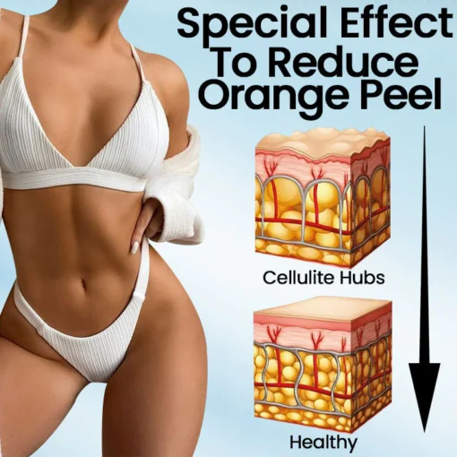 Furzero™ BeeVenom Fat Burner Cream - Image 7