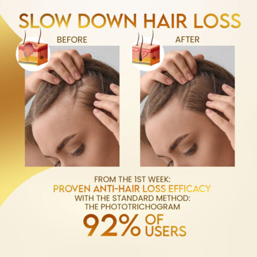 Stovis™ Biotin Boost Hair Growth Spray - Image 9