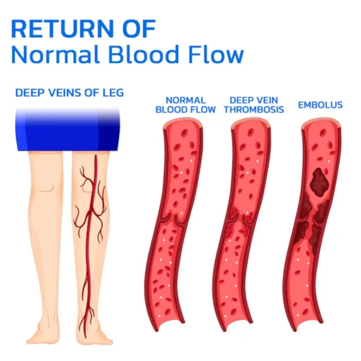 Furzero™ Turmeric Varicose Vein Patch - Image 8