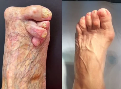 Posryst™ Bee Venom Joint and Gout Healing Gel - Image 5