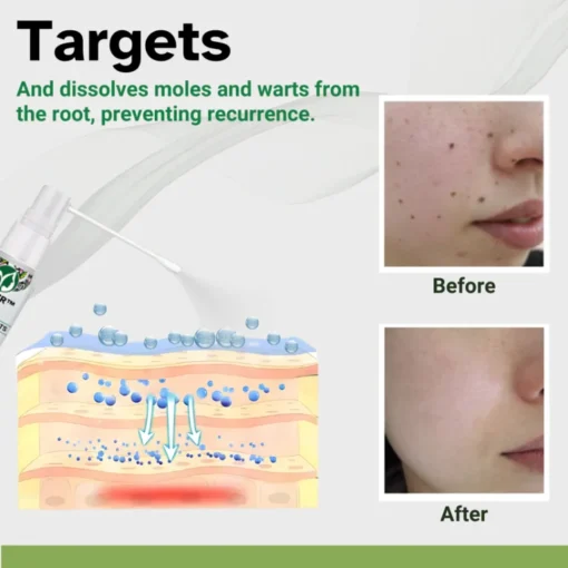 AEXZR™ Herbal Moles & Warts Removal Spray - Image 5