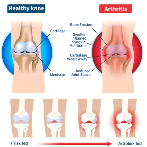 Posryst™ Bee Venom Joint and Gout Healing Gel - Image 4