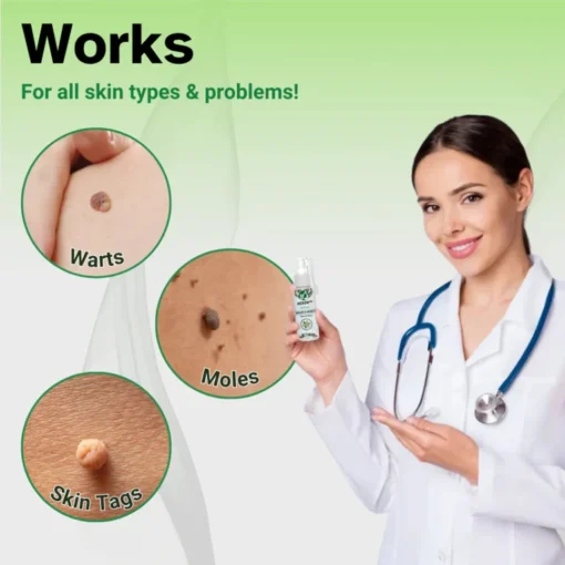 AEXZR™ Herbal Moles & Warts Removal Spray - Image 4