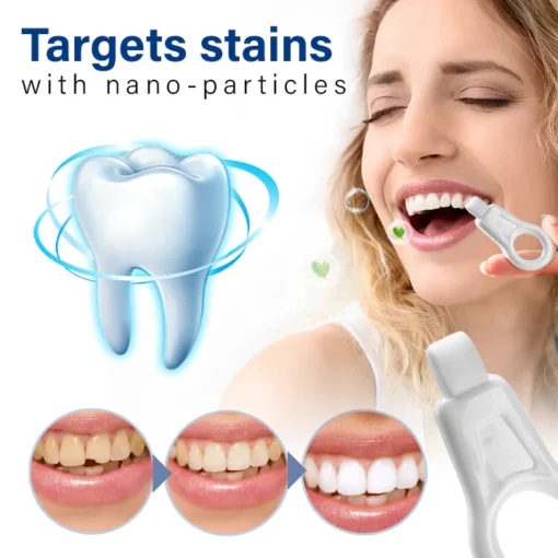 Oveallgo™ NanoShine Tooth Stain Cleaner - Image 4