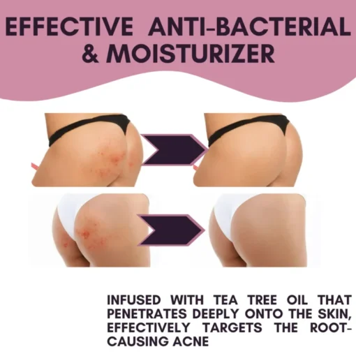 FLYCARE™ Butt Treatment Cream - Image 6