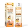 Fivfivgo™ Bee Venom Nail Fungus Spray