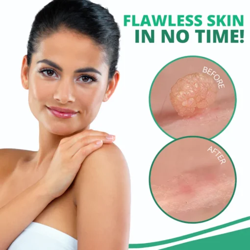 AEXZR™ Skin Tag Remover Patch - Image 4