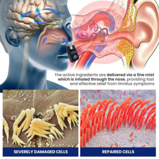 UNPREE™ TINNICLEAR Tinnitus Relief Nasal Inhaler - Image 3