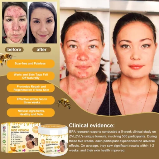Lotmay™ Bee Venom Skin Treatment Cream - Image 3