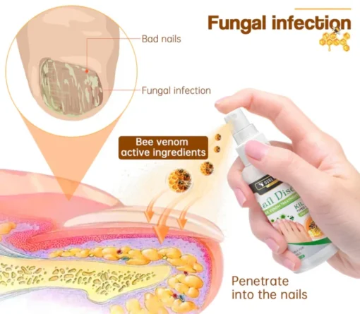 Fivfivgo™ Bee Venom Nail Fungus Spray - Image 5