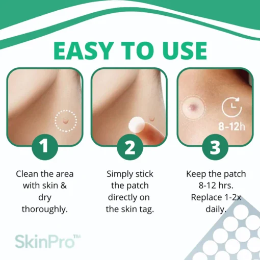 AEXZR™ Skin Tag Remover Patch - Image 3