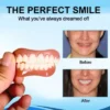 Perfect smile transformation with 𝐅𝐀𝐓𝐎𝐍𝐆™ denture set: before and after