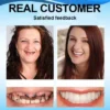 Real customer before and after using 𝐅𝐀𝐓𝐎𝐍𝐆™ denture set