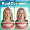 Before and after comparison with EzySmile™ veneers.