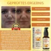 Wirkstoffe des ATTDX™ Serums: Apamin und Adolapin.