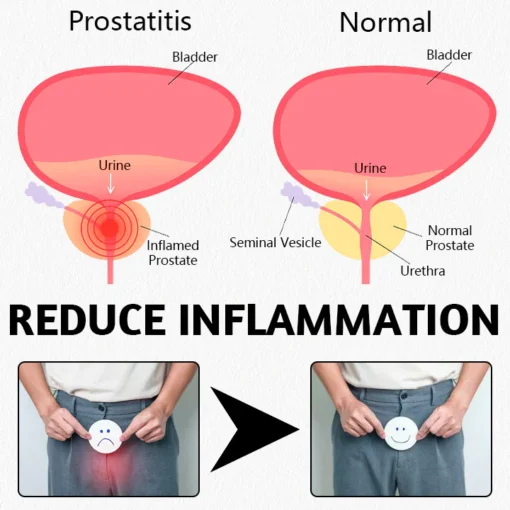 Ceoerty™ ProstaMagnetic Harmony Ring helps reduce inflammation in the prostate and bladder, promoting normal prostate function and easing urinary discomfort.