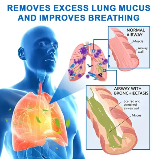 FLYCARE™ FreeLunga removes excess lung mucus, improves breathing, and supports normal airways, including those affected by bronchiectasis.