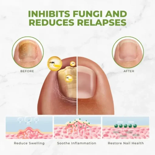 Biancat™ FungiVanish inhibits fungi, reduces relapses, soothes inflammation, and restores nail health for vibrant, strong nails.