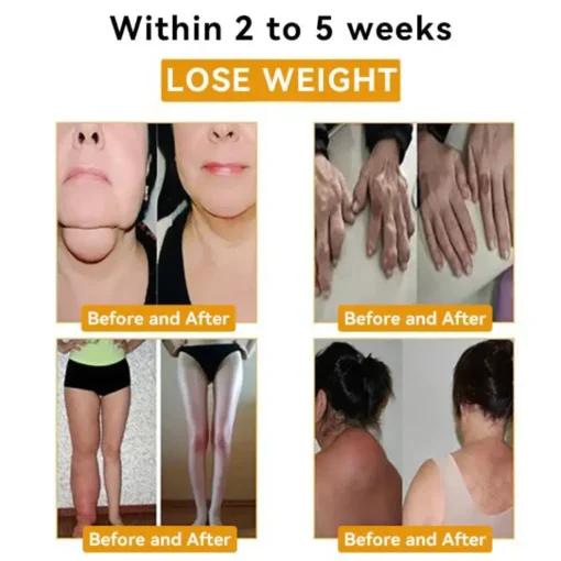 Experience weight loss within 2 to 5 weeks with the CZTICLE™ bracelet—see your transformation from before to after!