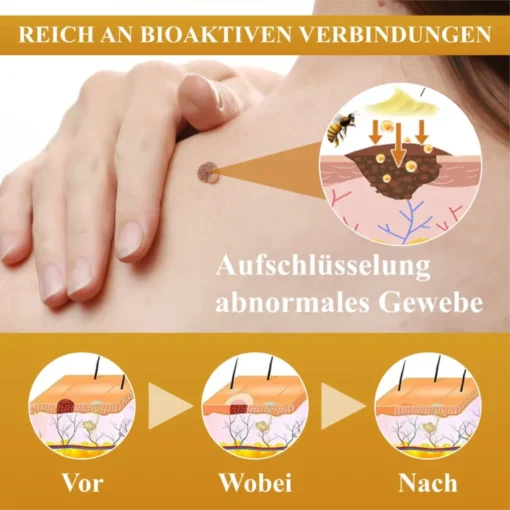 Anwendung des ATTDX™ Serums auf der Haut.