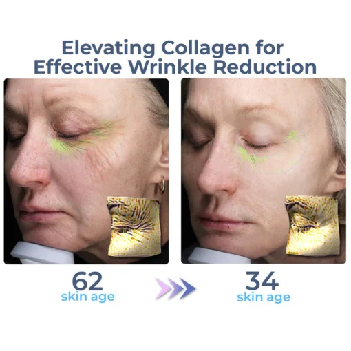 Elevating collagen in the flysmus™ Collagen Advanced Complete Eye Cream effectively reduces wrinkles, helping those with a skin age of 62 look as youthful as 34.