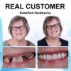 See real customer feedback with impressive before-and-after photos, highlighting the satisfaction and confidence gained from Smilehpy™ dentures!