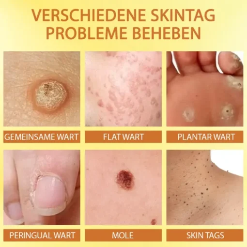 Wirkstoffe des ATTDX™ Serums: Apamin und Adolapin.