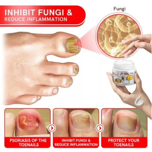 Close-up of FLYCARE™ Bee Venom Anti-Flare Psoriasis Cream on a wooden surface.