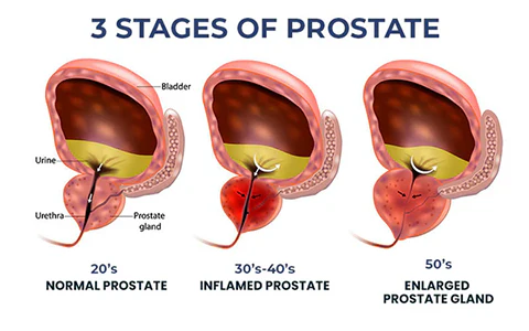 Elevate your health routine with Oveallgo™ BeeProsta Nasal Spray for Prostate Wellness, crafted for men’s wellness.