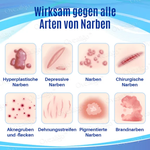 Oveallgo™ SilkScar Narbenbehandlung & Hautreparatur-Serum hilft, Rötungen zu reduzieren und die Hauttextur zu verbessern.