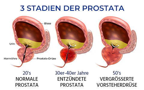 Genießen Sie ein besseres Lebensgefühl mit Oveallgo™ BeeProsta Nasenspray für die Prostatagesundheit – einfach in der Anwendung.