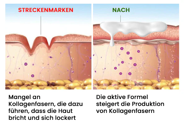 AEXZR™ Hautstraffende Bienengift-Creme: Unterstützt die Selbstheilung der Haut und sorgt für Gesundheit.