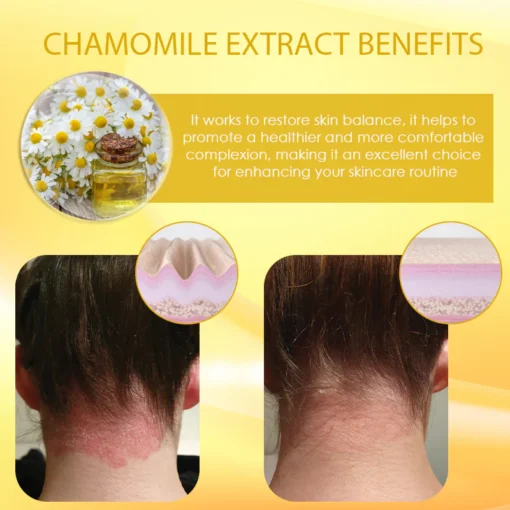 Discover the natural benefits of ATTDX™ Chamomile Skin Repairing Cleansing Pads for your skin.